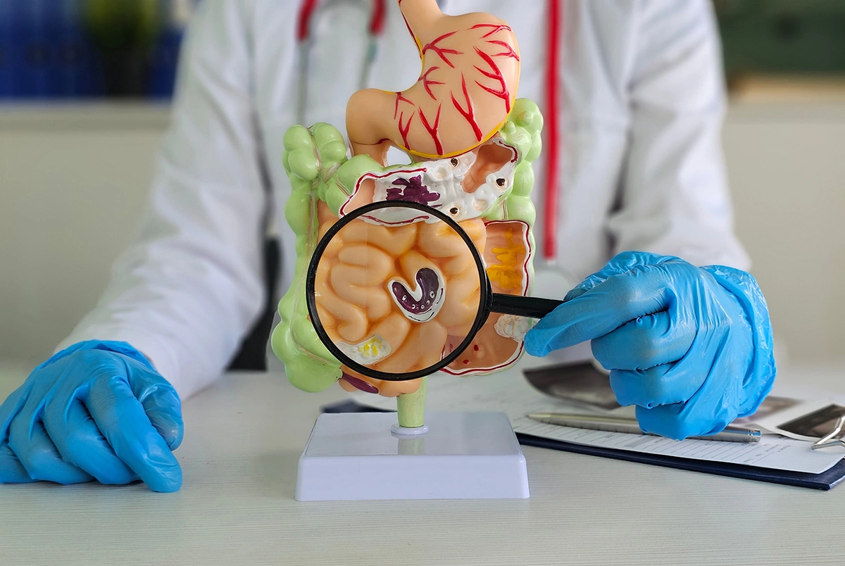 3D render of a colonoscopy checking for diseases in the colon.