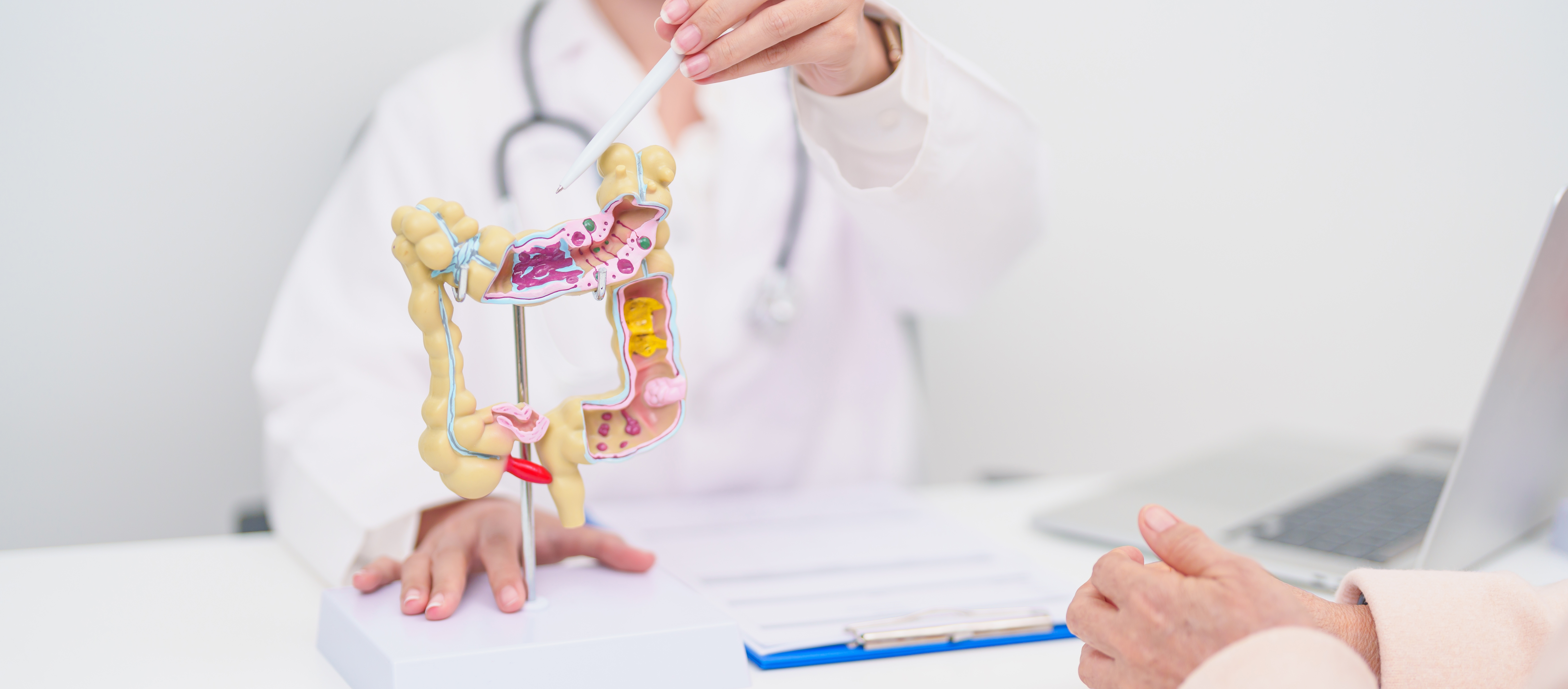 A doctor pointing to an anatomical diagram of the colon