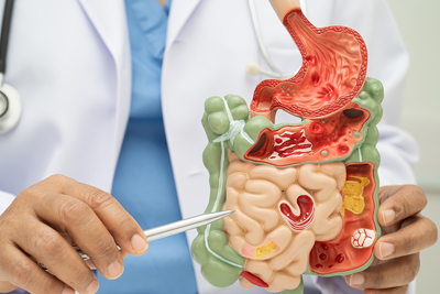 Endoscopy vs Medical Imaging for Digestive Symptoms 