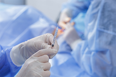 Colonoscopy Sedation: Local or General Anaesthesia?