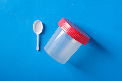 Colonoscopy vs Stool Test: Which Screening Method Is Right for You?