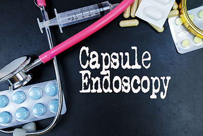 Capsule Endoscopy: A Non-Invasive Alternative to Traditional Endoscopy