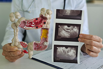 Colonoscopy Screening Guidelines