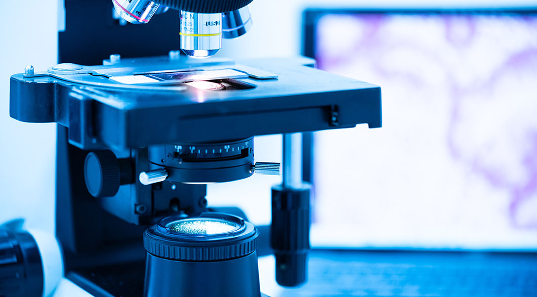 Understanding Biopsy and Pathology Results